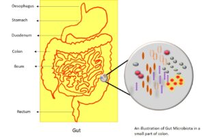 Synbiotic, Gut microbiota, Prebiotic. Dysbiosis symptoms, Probiotic